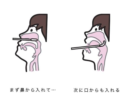 慢性上咽頭炎 日本病巣疾患研究会